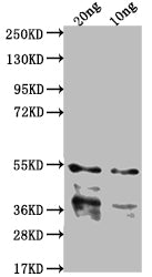 Western Blot
Positive WB detected in Recombinant protein
All lanes: IPAB antibody at 1:2000
Secondary
Goat polyclonal to rabbit IgG at 1/50000 dilution
Predicted band size: 40.2 kDa
Observed band size: 43 kDa