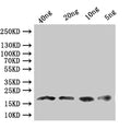 Western Blot
Positive WB detected in: recombinant protein
All lanes:Dll  Antibody at 1:1000
Secondary
Goat polyclonal to rabbit IgG at 1/50000 dilution
Predicted band size: 17.8 kDa
Observed band size: 18 kDa