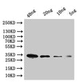 Western Blot
Positive WB detected in: recombinant protein
All lanes:tfpI Antibody at 1:1000
Secondary
Goat polyclonal to rabbit IgG at 1/50000 dilution
Predicted band size: 29 kDa
Observed band size: 34 kDa
