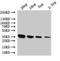 Western Blot
Positive WB detected in: recombinant protein
All lanes:SUI2 Antibody at 1:1000
Secondary
Goat polyclonal to rabbit IgG at 1/50000 dilution
Predicted band size: 37 kDa
Observed band size: 37 kDa