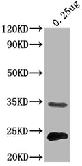 Western Blot
Positive WB detected in Recombinant protein
All lanes:eutC antibody at 1:2000
Secondary
Goat polyclonal to rabbit IgG at 1/50000 dilution
Predicted band size: 32 kDa
Observed band size: 32 kDa