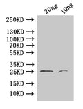 Western Blot
Positive WB detected in: recombinant protein
All lanes:24 Antibody at 1:1000
Secondary
Goat polyclonal to rabbit IgG at 1/50000 dilution
Predicted band size:25.1 kDa
Observed band size: 25 kDa