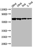 Western Blot
Positive WB detected in: recombinant protein
All lanes: cry2Ab Antibody at 1:1000
Secondary
Goat polyclonal to rabbit IgG at 1/50000 dilution
Predicted band size: 65 kDa
Observed band size: 65 kDa