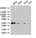 Western Blot
Positive WB detected in: recombinant protein
All lanes:ipaC Antibody at 1:1000
Secondary
Goat polyclonal to rabbit IgG at 1/50000 dilution
Predicted band size: 46.2 kDa
Observed band size: 47 kDa