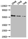 Western Blot
Positive WB detected in Recombinant protein
All lanes: UL49 antibody at 1:2000
Secondary
Goat polyclonal to rabbit IgG at 1/50000 dilution
Predicted band size: 50.6 kDa
Observed band size: 54 kDa
