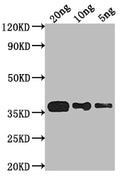 Western Blot
Positive WB detected in Recombinant protein
All lanes: phoP antibody at 1:2000
Secondary
Goat polyclonal to rabbit IgG at 1/50000 dilution
Predicted band size: 30.5 kDa
Observed band size: 37 kDa