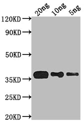 Western Blot
Positive WB detected in Recombinant protein
All lanes: phoP antibody at 1:2000
Secondary
Goat polyclonal to rabbit IgG at 1/50000 dilution
Predicted band size: 30.5 kDa
Observed band size: 37 kDa