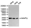 Western Blot
Positive WB detected in: recombinant protein
All lanes:betaTry Antibody at 1:1000
Secondary
Goat polyclonal to rabbit IgG at 1/20000 dilution
Predicted band size: 29.5 kDa
Observed band size: 29.5 kDa