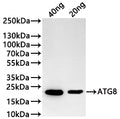 Western Blot
Positive WB detected in: recombinant protein
All lanes:SAP2 Antibody at 1:1000
Secondary
Goat polyclonal to rabbit IgG at 1/20000 dilution
Predicted band size: 42.5 kDa
Observed band size: 43 kDa