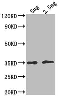 Western Blot
Positive WB detected in Recombinant protein
All lanes: DOT5 antibody at 1:2000
Secondary
Goat polyclonal to rabbit IgG at 1/50000 dilution
Predicted band size: 28.2 kDa
Observed band size: 36 kDa