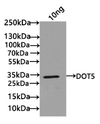 Western Blot
Positive WB detected in: recombinant protein
All lanes: DOT5 Antibody at 1:1000
Secondary
Goat polyclonal to rabbit IgG at 1/50000 dilution
Predicted band size: 25 kDa
Observed band size: 25 kDa