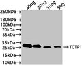 Western Blot
Positive WB detected in: recombinant protein
All lanes: TCTP1 Antibody at 1:1000
Secondary
Goat polyclonal to rabbit IgG at 1/50000 dilution
Predicted band size: 26 kDa
Observed band size: 30 kDa