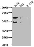 Western Blot
Positive WB detected in Recombinant protein
All lanes: TFC4 antibody at 1:2000
Secondary
Goat polyclonal to rabbit IgG at 1/50000 dilution
Predicted band size: 54.9 kDa
Observed band size: 61 kDa