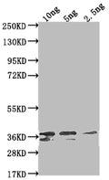 Western Blot
Positive WB detected in Recombinant protein
All lanes: Non-structural polyprotein antibody at 1:2000
Secondary
Goat polyclonal to rabbit IgG at 1/50000 dilution
Predicted band size: 31.4 kDa
Observed band size: 36 kDa