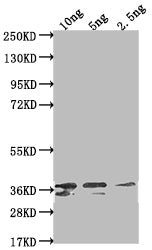 Western Blot
Positive WB detected in Recombinant protein
All lanes: Non-structural polyprotein antibody at 1:2000
Secondary
Goat polyclonal to rabbit IgG at 1/50000 dilution
Predicted band size: 31.4 kDa
Observed band size: 36 kDa