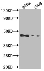 Western Blot
Positive WB detected in Recombinant protein
All lanes: Non-structural polyprotein antibody at 1:2000
Secondary
Goat polyclonal to rabbit IgG at 1/50000 dilution
Predicted band size: 37.1 kDa
Observed band size: 47 kDa