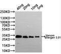 Western Blot
Positive WB detected in: recombinant protein
All lanes:Venom allergen 5.01 Antibody at 1:1000
Secondary
Goat polyclonal to rabbit IgG at 1/20000 dilution
Predicted band size: 29.6 kDa
Observed band size: 29.6 kDa