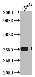 Western Blot
Positive WB detected in Recombinant protein
All lanes: RAD51 antibody at 1:2000
Secondary
Goat polyclonal to rabbit IgG at 1/50000 dilution
Predicted band size: 34.3 kDa
Observed band size: 38 kDa