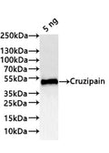 Western Blot
Positive WB detected in: recombinant protein
All lanes:Cruzipain Antibody at 1:1000
Secondary
Goat polyclonal to rabbit IgG at 1/20000 dilution
Predicted band size: 49.3 kDa
Observed band size: 49 kDa