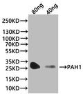 Western Blot
Positive WB detected in: recombinant protein
All lanes:PAH1 Antibody at 1:1000
Secondary
Goat polyclonal to rabbit IgG at 1/20000 dilution
Predicted band size: 30.4 kDa
Observed band size: 30 kDa