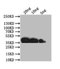 Western Blot
Positive WB detected in: recombinant protein
All lanes: ompP Antibody at 1:1000
Secondary
Goat polyclonal to rabbit IgG at 1/50000 dilution
Predicted band size: 37 kDa
Observed band size: 37 kDa