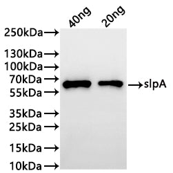 Western Blot
Positive WB detected in: recombinant protein
All lanes:slpA Antibody at 1:1000
Secondary
Goat polyclonal to rabbit IgG at 1/20000 dilution
Predicted band size: 51.7 kDa
Observed band size: 60 kDa