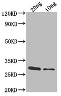 Western Blot
Positive WB detected in Recombinant protein
All lanes: ygcB antibody at 1:2000
Secondary
Goat polyclonal to rabbit IgG at 1/50000 dilution
Predicted band size: 31.8 kDa
Observed band size: 32 kDa