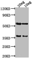 Western Blot
Positive WB detected in Recombinant protein
All lanes: SALM antibody at 1:2000
Secondary
Goat polyclonal to rabbit IgG at 1/50000 dilution
Predicted band size: 38 kDa
Observed band size: 58 kDa