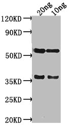 Western Blot
Positive WB detected in Recombinant protein
All lanes: SALM antibody at 1:2000
Secondary
Goat polyclonal to rabbit IgG at 1/50000 dilution
Predicted band size: 38 kDa
Observed band size: 58 kDa