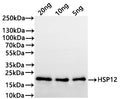 Western Blot
Positive WB detected in: recombinant protein
All lanes:HSP12 Antibody at 1:1000
Secondary
Goat polyclonal to rabbit IgG at 1/20000 dilution
Predicted band size: 18.6 kDa
Observed band size: 19 kDa