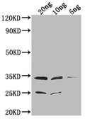 Western Blot
Positive WB detected in Recombinant protein
All lanes: EPTA antibody at 1:2000
Secondary
Goat polyclonal to rabbit IgG at 1/50000 dilution
Predicted band size: 34.1 kDa
Observed band size: 34 kDa