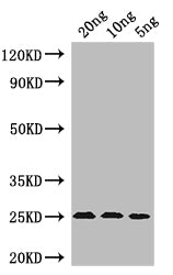 Western Blot
Positive WB detected in: recombinant protein
All lanes: MIC60 Antibody at 1:1000
Secondary
Goat polyclonal to rabbit IgG at 1/50000 dilution
Predicted band size: 24 kDa
Observed band size: 24 kDa