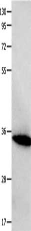 Gel: 10+12%SDS-PAGE, Lysate: 40 ug, Lane: Mouse heart tissue, Primary antibody: CSB-PA336705(FOXS1 Antibody) at dilution 1/200, Secondary antibody: Goat anti rabbit IgG at 1/8000 dilution, Exposure time: 10 seconds