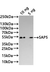 Western Blot
Positive WB detected in: recombinant protein
All lanes:SAP5 Antibody at 1:1000
Secondary
Goat polyclonal to rabbit IgG at 1/20000 dilution
Predicted band size: 44.1 kDa
Observed band size: 44 kDa
