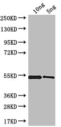 Western Blot
Positive WB detected in: recombinant protein
All lanes: MRC1 Antibody at 1:1000
Secondary
Goat polyclonal to rabbit IgG at 1/50000 dilution
Predicted band size: 51 kDa
Observed band size: 51 kDa