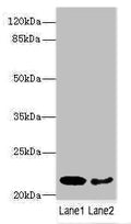 Western blot
All lanes: PRDX2 antibody at 9ug/ml
Lane 1: Mouse liver tissue
Lane 2: Mouse spleen tissue
Secondary
Goat polyclonal to rabbit IgG at 1/10000 dilution
Predicted band size: 22, 16 kDa
Observed band size: 22 kDa