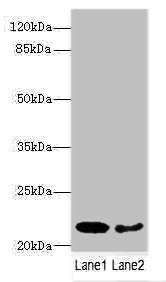 Western blot
All lanes: PRDX2 antibody at 9ug/ml
Lane 1: Mouse liver tissue
Lane 2: Mouse spleen tissue
Secondary
Goat polyclonal to rabbit IgG at 1/10000 dilution
Predicted band size: 22, 16 kDa
Observed band size: 22 kDa
