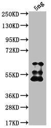 Western Blot
Positive WB detected in Recombinant protein
All lanes: TFC3 antibody at 1:2000
Secondary
Goat polyclonal to rabbit IgG at 1/50000 dilution
Predicted band size: 56.1 kDa
Observed band size: 63 kDa