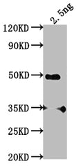 Western Blot
Positive WB detected in Recombinant protein
All lanes: SWD2 antibody at 1:2000
Secondary
Goat polyclonal to rabbit IgG at 1/50000 dilution
Predicted band size: 40.2 kDa
Observed band size: 46 kDa
