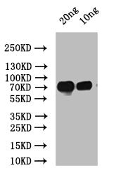 Western Blot
Positive WB detected in: recombinant protein
All lanes: spaP Antibody at 1:1000
Secondary
Goat polyclonal to rabbit IgG at 1/50000 dilution
Predicted band size: 60 kDa
Observed band size: 60 kDa