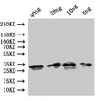 Western Blot
Positive WB detected in: recombinant protein
All lanes:ompA Antibody at 1:1000
Secondary
Goat polyclonal to rabbit IgG at 1/50000 dilution
Predicted band size: 24 kDa
Observed band size: 31 kDa