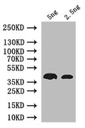 Western Blot
Positive WB detected in: recombinant protein
All lanes: nos Antibody at 1:1000
Secondary
Goat polyclonal to rabbit IgG at 1/50000 dilution
Predicted band size: 38 kDa
Observed band size: 38 kDa