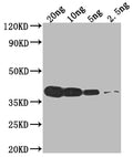 Western Blot
Positive WB detected in Recombinant protein
All lanes: VCATH antibody at 1:2000
Secondary
Goat polyclonal to rabbit IgG at 1/50000 dilution
Predicted band size: 39.9 kDa
Observed band size: 40 kDa