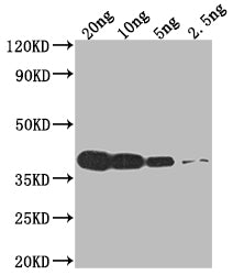 Western Blot
Positive WB detected in Recombinant protein
All lanes: VCATH antibody at 1:2000
Secondary
Goat polyclonal to rabbit IgG at 1/50000 dilution
Predicted band size: 39.9 kDa
Observed band size: 40 kDa