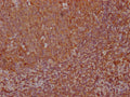 IHC image of CSB-PA343703LA01HU diluted at 1:100 and staining in paraffin-embedded human tonsil tissue performed on a Leica BondTM system. After dewaxing and hydration, antigen retrieval was mediated by high pressure in a citrate buffer (pH 6.0). Section was blocked with 10% normal goat serum 30min at RT. Then primary antibody (1% BSA) was incubated at 4°C overnight. The primary is detected by a Goat anti-rabbit IgG labeled by HRP and visualized using 0.05% DAB.