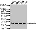 Western Blot
Positive WB detected in: recombinant protein
All lanes: MTM1 Antibody at 1:1000
Secondary
Goat polyclonal to rabbit IgG at 1/50000 dilution
Predicted band size: 21 kDa
Observed band size: 21 kDa