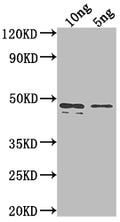 Western Blot
Positive WB detected in Recombinant protein
All lanes: rpaA antibody at 1:2000
Secondary
Goat polyclonal to rabbit IgG at 1/50000 dilution
Predicted band size: 43.3 kDa
Observed band size: 45 kDa