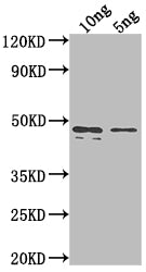 Western Blot
Positive WB detected in Recombinant protein
All lanes: rpaA antibody at 1:2000
Secondary
Goat polyclonal to rabbit IgG at 1/50000 dilution
Predicted band size: 43.3 kDa
Observed band size: 45 kDa
