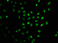 Immunofluorescence staining of Hela cells with CSB-PA345128LA01HU at 1:100, counter-stained with DAPI. The cells were fixed in 4% formaldehyde, permeabilized using 0.2% Triton X-100 and blocked in 10% normal Goat Serum. The cells were then incubated with the antibody overnight at 4°C. The secondary antibody was Alexa Fluor 488-congugated AffiniPure Goat Anti-Rabbit IgG(H+L).