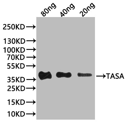 Western Blot
Positive WB detected in: recombinant protein
All lanes:tasA Antibody at 1:1000
Secondary
Goat polyclonal to rabbit IgG at 1/20000 dilution
Predicted band size: 32 kDa
Observed band size: 38 kDa